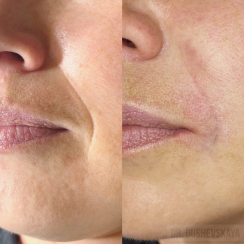 Екатерина Душевская, Yekaterinburg Фото - 5