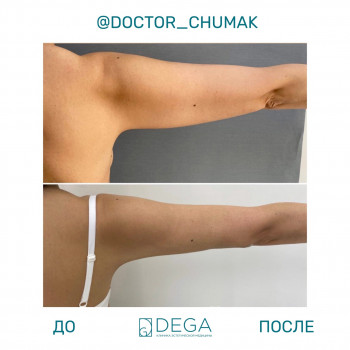 DEGA, Saint Petersburg Фото - 5