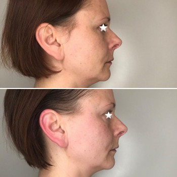 Regeneris, Люблин Фото - 5