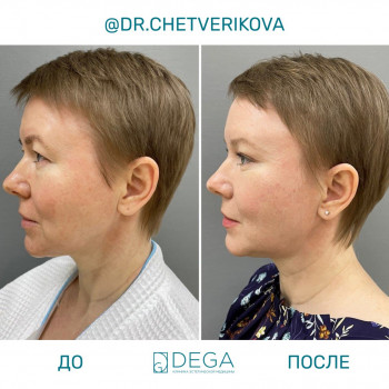 Марина Анатольевна Четверикова, Saint Petersburg Фото - 5