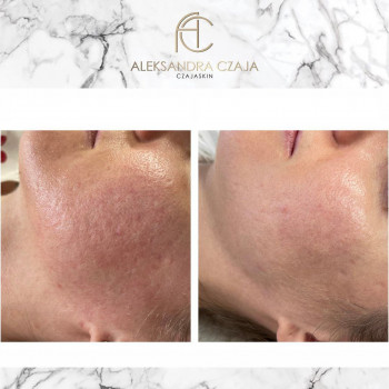 Александра Чая, Варшава Фото - 5