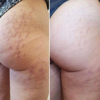 Dzhoanna Karpinska, Lublin Фото - 5