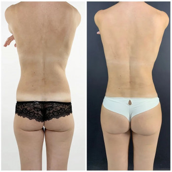 Федор Янович Красковский, Moscow Фото - 5