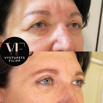 Филипп Владимирович Выступец, Москва Фото - 5