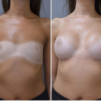 Илья Харисович Баталов, Saint Petersburg Фото - 5