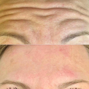 Татьяна Рыбалова, Tyumen Фото - 5