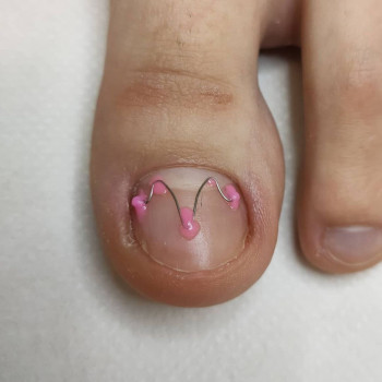 Виктория Заяц, Люблин Фото - 5