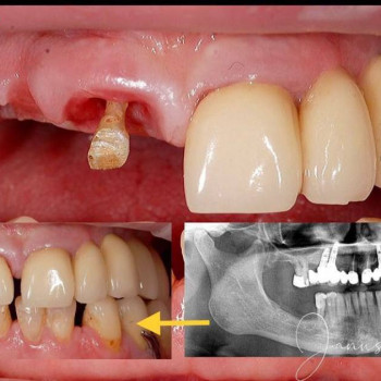 Yanus , Lublin Фото - 5