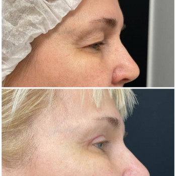 Нона Георгиевна Кикория, Saint Petersburg Фото - 5