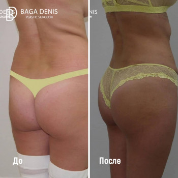 Денис Константинович Бага, Saint Petersburg Фото - 5