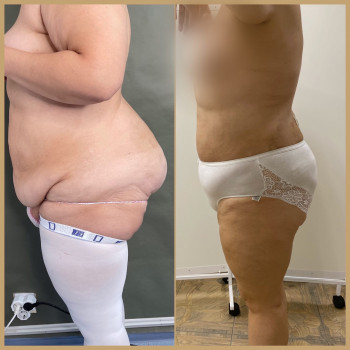 Александр Анатольевич Дмитриев, Saint Petersburg Фото - 5