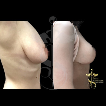 Ирина Ильинична Саркисян, Saint Petersburg Фото - 5