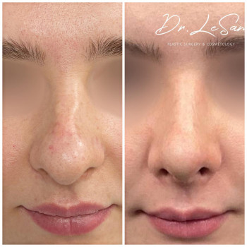 Лена Самвеловна Саносян, Saint Petersburg Фото - 5