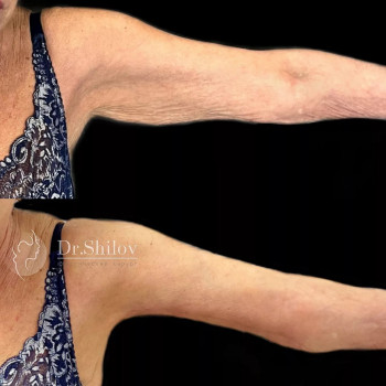 Олег Павлович Шилов, Saint Petersburg Фото - 5