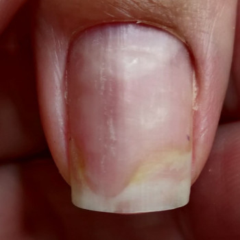 Центр подолога Наталии Надыч, Москва Фото - 5