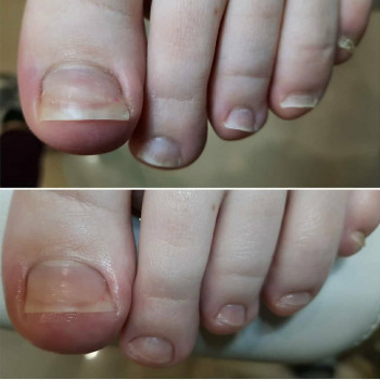 Центр подолога Наталии Надыч, Москва Фото - 6