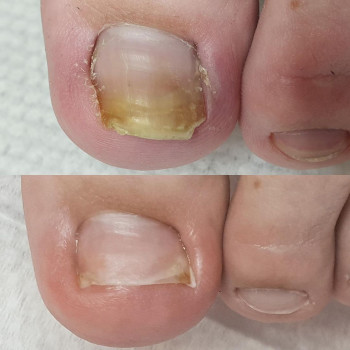 Медицинский центр подологии и дерматологии Татьяны Красюк, Moscow Фото - 5