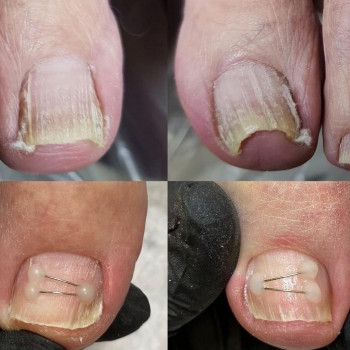 Анна Матвеева, Moscow Фото - 5