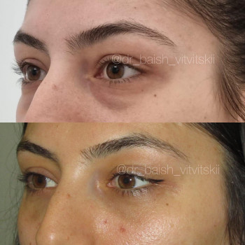 Баиш Александрович Витвицкий, Saint Petersburg Фото - 5