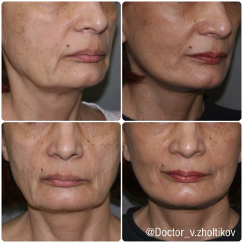 Виталий Владимирович Жолтиков, Санкт-Петербург Фото - 5