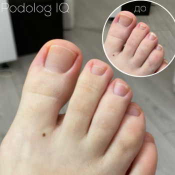 Podologi, Saint Petersburg Фото - 5