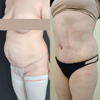 Николай Владимирович Муравьев, Saint Petersburg Фото - 5