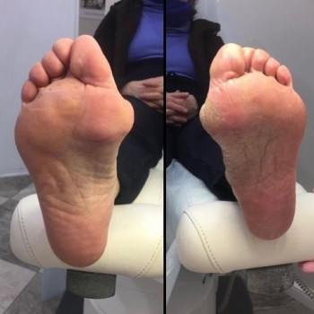 Первый  Центр Подологии, Санкт-Петербург Фото - 5