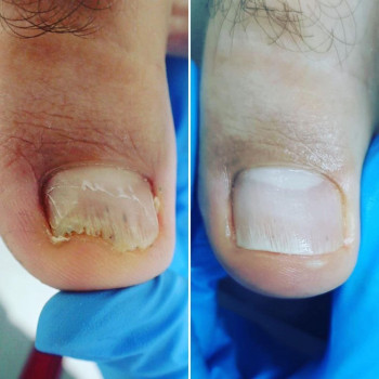 Первый  Центр Подологии, Санкт-Петербург Фото - 6