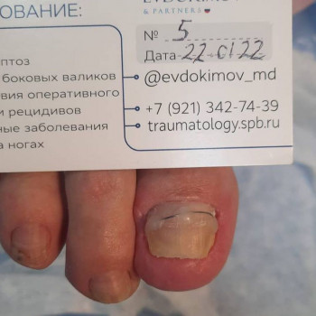 Михаил Евдокимов, Saint Petersburg Фото - 6