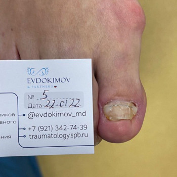 Михаил Евдокимов, Saint Petersburg Фото - 7