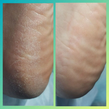 Елена Румянцева, Saint Petersburg Фото - 5