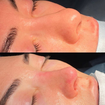 Гарик Артурович Чатинян, Novosibirsk Фото - 5