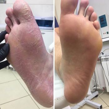 Анна Шутова, Novosibirsk Фото - 5