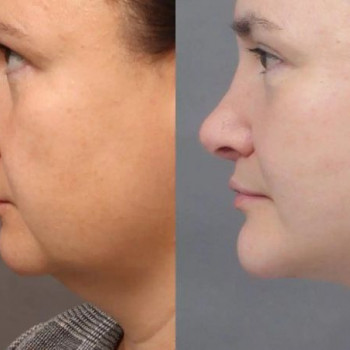 Георгий Александрович Колыванов, Екатеринбург Фото - 5