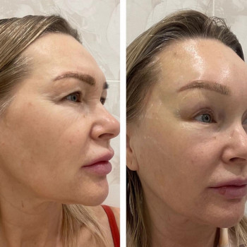 Андрей Сапрыгин, Yekaterinburg Фото - 5