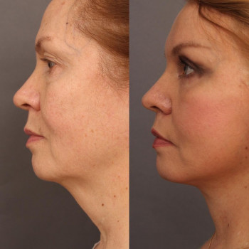 Виталий Анатольевич Головач, Yekaterinburg Фото - 5