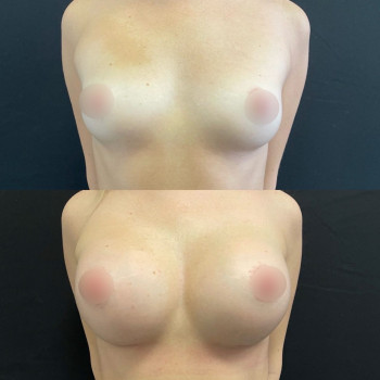 Алиса Игоревна Пацюк, Saint Petersburg Фото - 5