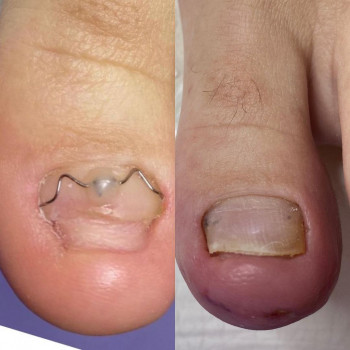 Наталья Николайчук, Krasnodar Фото - 5