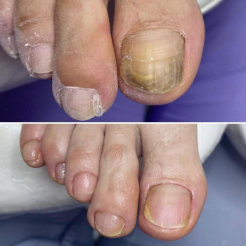 Наталья Николайчук, Krasnodar Фото - 6