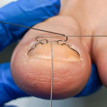 Татьяна Зорина, Krasnodar Фото - 5