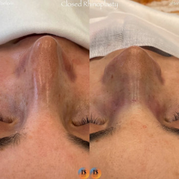 Давид Левонович Сафарян, Moscow Фото - 5