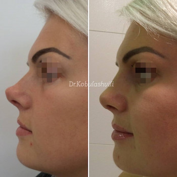 Тимур Гивиевич Кобулашвили, Москва Фото - 5