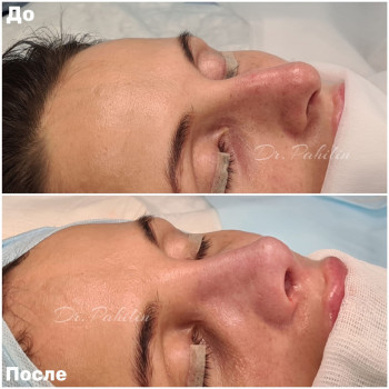 Дмитрий Викторович Пахилин, Moscow Фото - 5