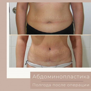 Андрей Леонидович Ищенко, Moscow Фото - 5