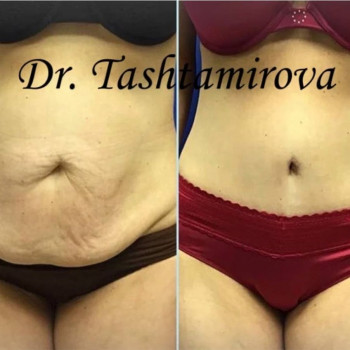 Айна Османовна Таштамирова, Москва Фото - 5