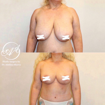 Аделина Фуатовна Алтыева, Moscow Фото - 5