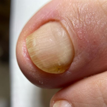 Матильда, Москва Фото - 5