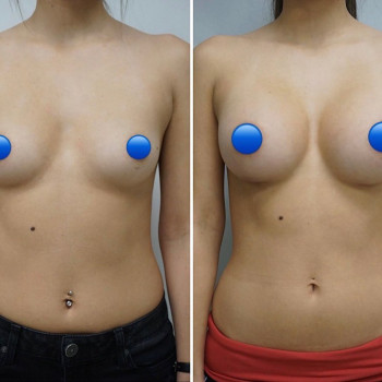 Григорий Викторович Перекрестов, Moscow Фото - 5