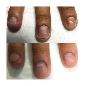 Наталия Космацкая, Saint Petersburg Фото - 5