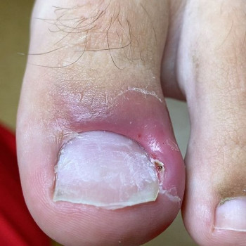 Вероника Пимбурская, Saint Petersburg Фото - 5